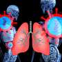 Younger adults with lung cancer more likely to have targetable genetic changes, study finds