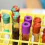 Liquid biopsy predicts response to breast cancer immunotherapy