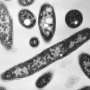 What to know about Legionnaires' disease making people sick on New York's Upper East Side